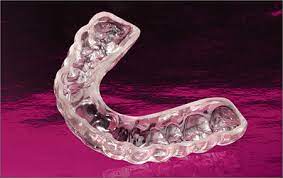 The instructions i was given for cleaning were to simply rinse in hot water before and after every use to get limescale of anything i tend to use vinegar (well on anything that could come into contact with. What S The Easiest Way To Clean My Retainer Or Nightguard