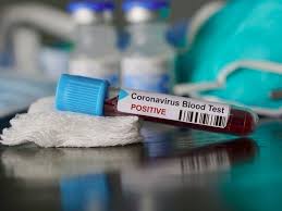 4115 jacksol dr, bldg 2, rooms1, 4 & 5. Positive Coronavirus Test Leads To San Jose School Closure Los Gatos Ca Patch