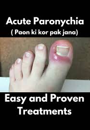 Image result for Paronychia feet