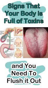 Signs That Your Body Is Full Of Toxins And You Need To Flush It Out Tongue Health Natural Health Tips Detox Your Liver