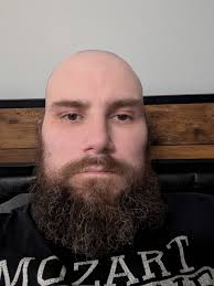 My mate is thinking of shaving his balding head. Could you please photo  shop him with a shaven head so we can see what it looks like. This is a  massive moment