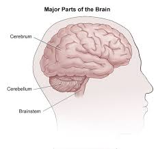 effects of stroke johns hopkins medicine