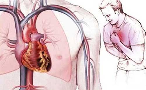 NGUYÊN NHÂN VÀ CÁC DẤU HIỆU NHẬN BIẾT MẮC BỆNH TIM MẠCH