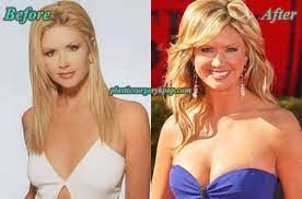 In case of o'dell, the surgery is effectual in fighting against aging for. Nancy O Dell Plastic Surgery Before And After Pictures