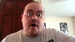 Globe luxation is the medical term for when an eyeball protrudes or pops out of the eye socket. Man Eats Hot Wing And His Eyes Pop Out His Head By Yaboymike