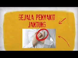 7) sakit kepala, sakit kepala pada gejala awal penyakit jantung bisanya sangat menyakitkan ini terjadi karena aliran darah ke otak terganggu dan tidak normal. Ciri Ciri Gejala Awal Sakit Jantung Youtube