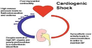 Shock | IntechOpen