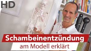 Schambeinentzundung Vielfatige Schmerzen Eine Diagnose Liebscher Bracht