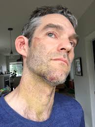 There's a leash law in Haralson County. Let my bike go to protect my  daughter who was