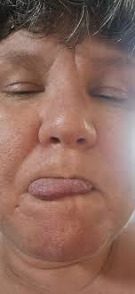 i feel so guilty. had a major major wobble last night, scratched my arms to  bits so bad ive only just been able to look at them. i feel so bad and