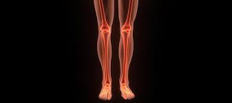 Involvement of other parts of the skeleton, most commonly the hips, occurs in less. What Are The Main Symptoms Of Bone Cancer