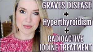 My Graves Disease Hyperthyroidism And Radioactive Iodine Treatment Youtube