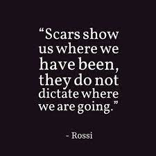 تويتر Peter Gregg على تويتر Scars Show Us Where We Have Been They Do Not Dictate Where We Are Going David Rossi Leadership Https T Co H0f6jynb3g