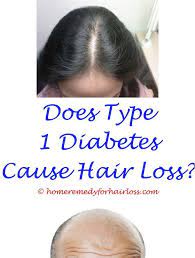 Hair Loss Process Garnier Nutrisse Hair Color Hair Loss Christian Dream Interpretation Hair Loss How L Vitamins For Hair Loss Oil For Hair Loss Dog Hair Loss