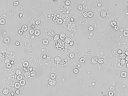 Image result for Stool Leukocytes