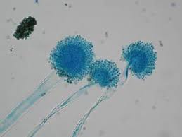 Aspergillus fumigatus est très fréquent sur les matières organiques humides en décomposition, le compost, le sol, l'air… Aspergillus Flavus Alchetron The Free Social Encyclopedia