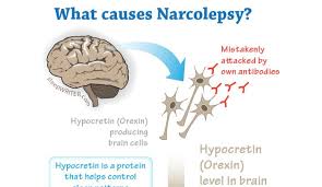 Pin By Aliha William B On Health Narcolepsy Narcolepsy Sleep Problems Rem Sleep