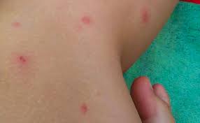 We did not find results for: Parasiten Im Tegernsee Tegernseerstimme