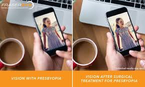 Image result for Presbyopia