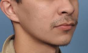 Cheek
