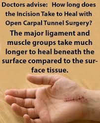 Pin On Recovery Times Carpal Tunnel Surgery
