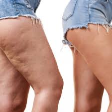 Epingle Sur Creme Anti Ride