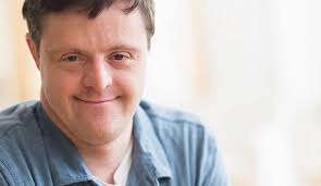 About 95% of people with down syndrome have trisomy 21. Adult Down Syndrome Condition Ut Southwestern Medical Center