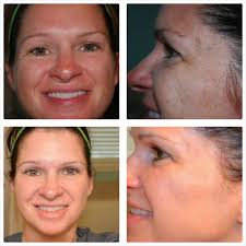 Norma Fatchen- Rodan + Fields Dermatologists