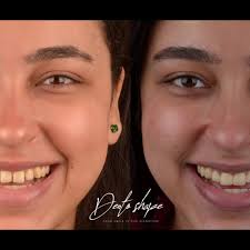 Dr.Amgad Hassan Soliman (@dentoshape) • Instagram photos and videos