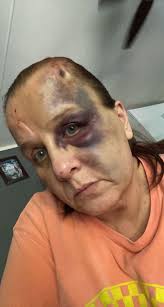 Alcohol led me here But God saved me 3 years toxic free and I'm so glad I  didn't succeed because life has taught me no matter what you have to love  and