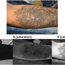 This natural healing process causes the tattoo to fade with minimal risk of scarring. The Experimental Setup For Monitoring The Laser Tattoo Removal Process Download Scientific Diagram