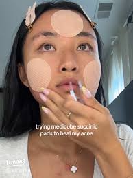 57 top Medicube Air Shot Acne Scar ideas in 2025