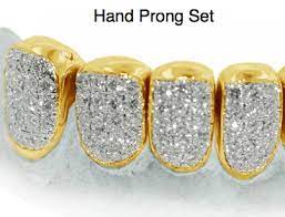 Free molding kit when you buy gold. Gold Teeth Dental Are You Looking For Dentist Who Do Permanent Gold Teeth