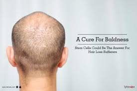 If i had tried just a. A Cure For Baldness Stem Cells Could Be The Answer For Hair Loss Sufferers Lybrate