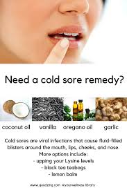Tried And Tested Home Remedies For Your Cold Sores How To Get Rid Of A Cold Sore Fast Cold Sores Remedies Canker Sore Cold Sore