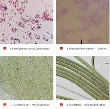 Rhodospirillum rubrum (esmarch 1887) molisch 1907 is the type species of the genus rhodospirillum, which is the type genus of the family rhodospirillaceae in the class. Solved Look At The 2 Gram Stain Slide This Is A Gram Sta Chegg Com