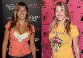 3is jodie sweetin plastic surgery justifiable? Jodie Sweetin Boob Job Before And After Photos Boob Job Before And After