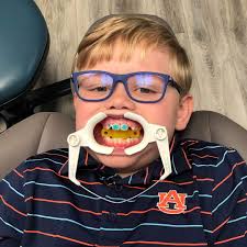 Grayson was so brave today while his mom, Dr. Limbaugh, welcomed him to the  wonderful world of braces! We are all so proud of him and love his new  smile! #limbaughorthodontics #livelifesmiling