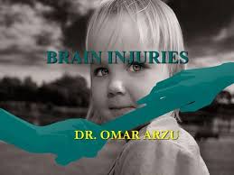 soft markers of chromosomal anomalies.pptx