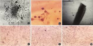 The dermal papilla provides nutrition by extending from the dermis into the hair bulb. Dermal Papilla Cells Grow Out From Dermal Papilla Separated They Look Download Scientific Diagram
