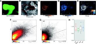 Live stream plus station schedule and song playlist. Simultaneous Structural And Elemental Nano Imaging Of Human Brain Tissue Chemical Science Rsc Publishing