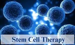 Exclusive Stem Cell Therapy Luncheon at Davison