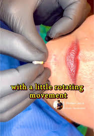 Image result for Gag Reflex