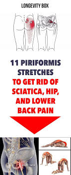 Pin On Sciatica