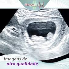 Prevencardio Clinica De Especialidades
