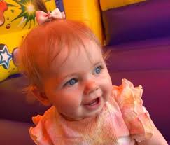 Toddler with rare epilepsy needs surgery to detach part of her brain