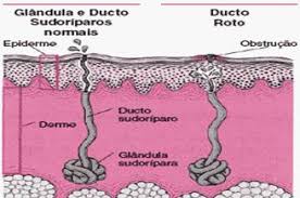 Resultado de imagen para glandulas sudoríparas para dibujar