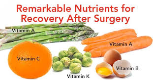 Which Foods Speed Up Recovery After Surgery Recovery Food Healing Food Foods To Eat