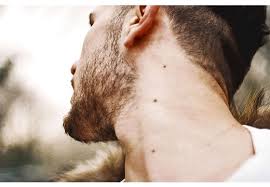 Rodimoe Pyatno Na Shee Chto Oznachaet Rodinka Na Shee Volokonovskij Rajon