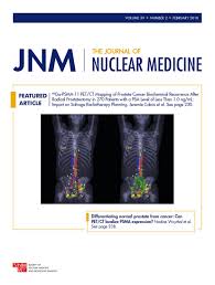 Detector designs utilizing nonradioactive crystalline materials are advantageous because the high background signal associated with the. Aacr Snmmi State Of The Art Molecular Imaging In Cancer Biology And Therapy Abstracts Journal Of Nuclear Medicine